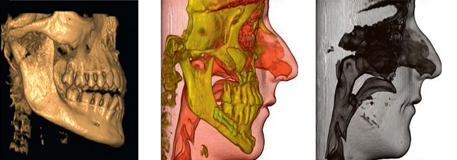 3D Images That Speak More Than Words.